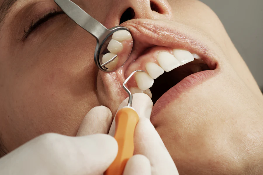 Imagen de muestra · dental · 2
